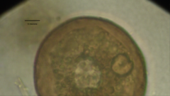 Arcella hemisphaerica