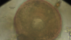 Arcella hemisphaerica