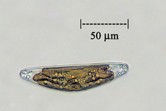 Cymbella