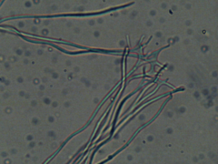 Diderma saundersii