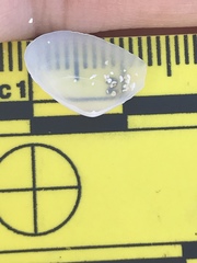 Donacidae