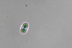 Gyalolechia xanthostigmoidea