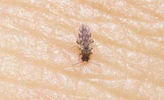 Culicoides
