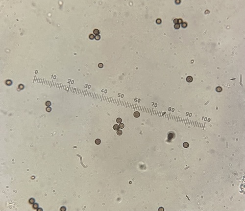 Myceliostroma (Photo 5 of 6)