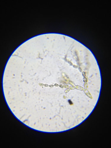 Batrachospermum observed 2023-07-28