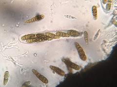 Splanchnonema platani