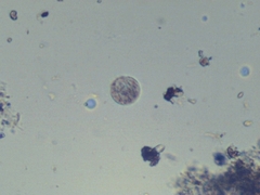 Entamoeba coli
