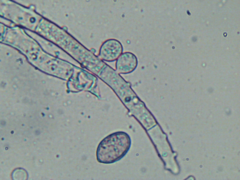 Botryobasidium conspersum