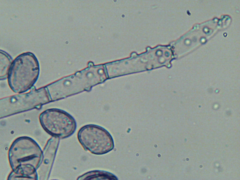 Botryobasidium conspersum