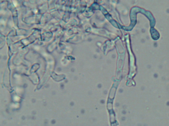 Hyphodontia arguta