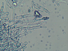 Hyphodontia arguta