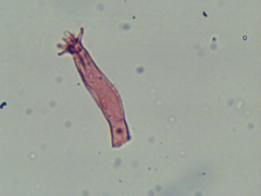 Dendrothele corniculata