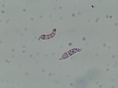 Dendrothele corniculata