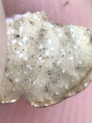 Lobaria anomala