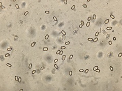 Hygrocybe acutoconica image
