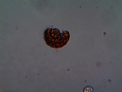 Eutardigrada