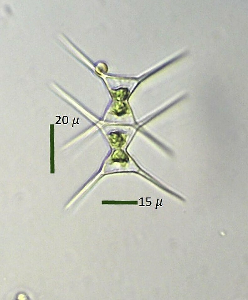 Staurodesmus incus from Ledyard, CT, USA - Long Pond on July 31, 2023 ...