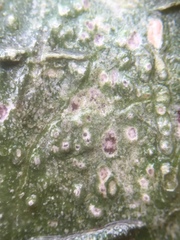 Pertusaria leioplaca