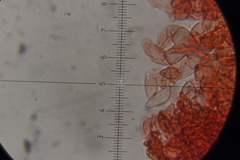 Botryobasidium vagum