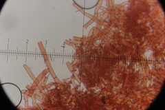 Botryobasidium vagum