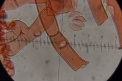 Botryobasidium vagum