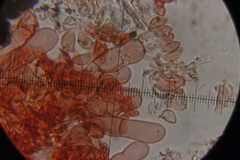 Botryobasidium vagum