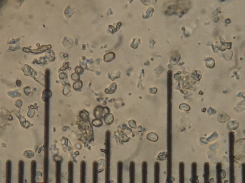 Representative image of Trichosporonaceae