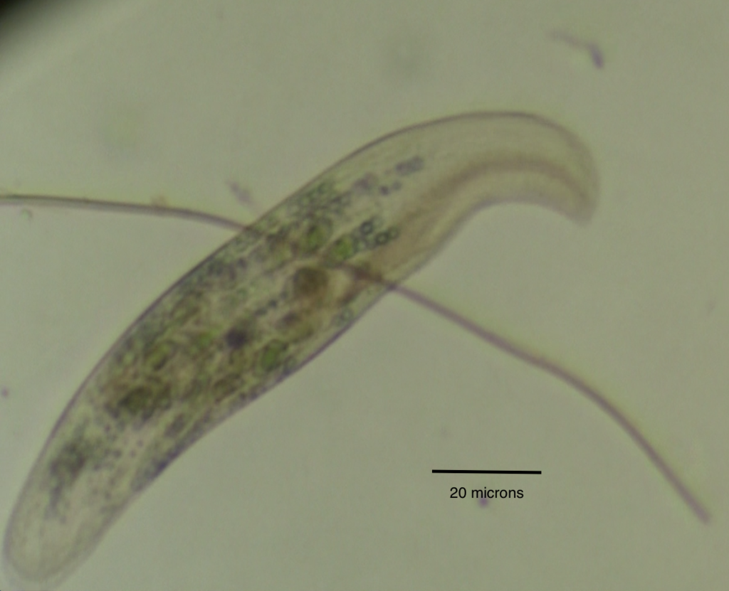 spirostomum under microscope 400x