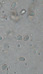 Hygrocybe astatogala image