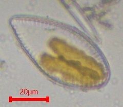 Surirella