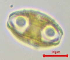 Bacillariophyceae