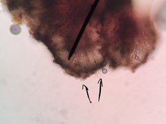 Arthonia lapidicola image