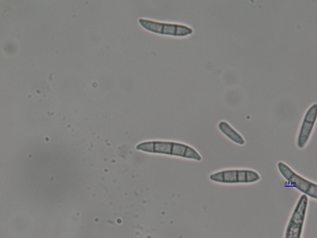 Fusarium equiseti