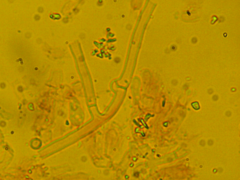 Athelia epiphylla