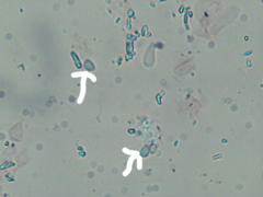 Athelia epiphylla