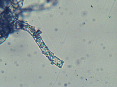 Athelia epiphylla