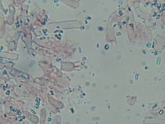 Athelia epiphylla