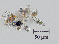 Cymbella