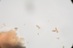 Calicium montanum