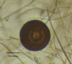 Arcella hemisphaerica