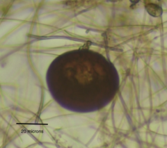 Arcella hemisphaerica