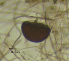 Arcella hemisphaerica