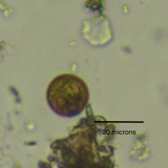 Trachelomonas volvocina