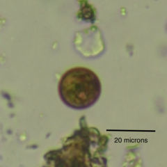 Trachelomonas volvocina