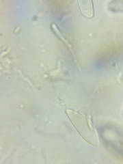 Cudoniella acicularis image