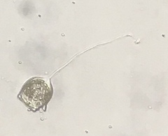 Vorticella campanula