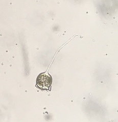 Vorticella campanula