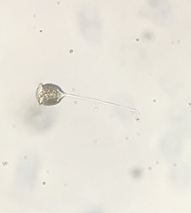 Vorticella campanula