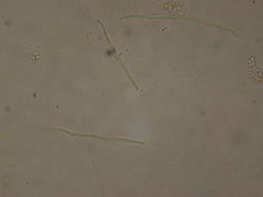 Acaulopage macrospora