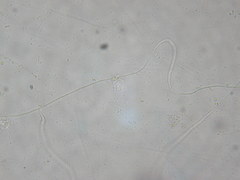 Acaulopage macrospora